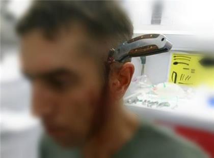 hombre con cuchillo en la cabeza