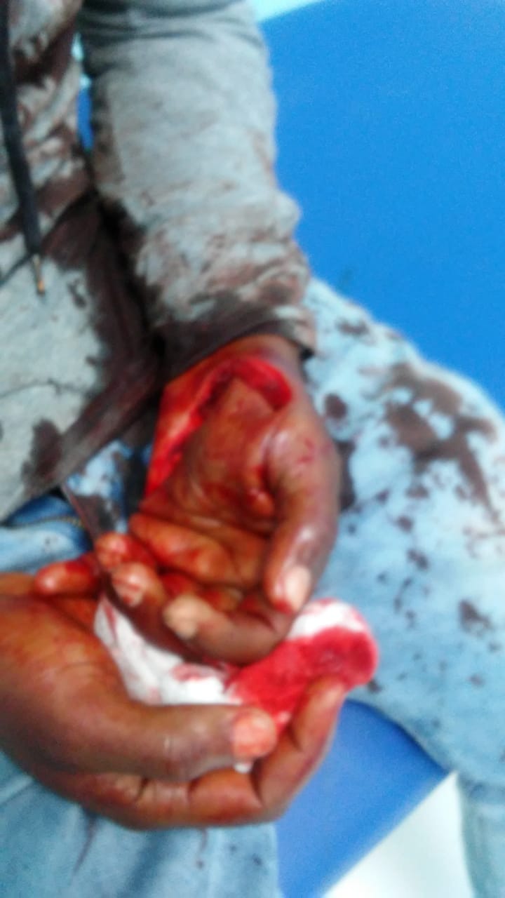 Herido San Juan
