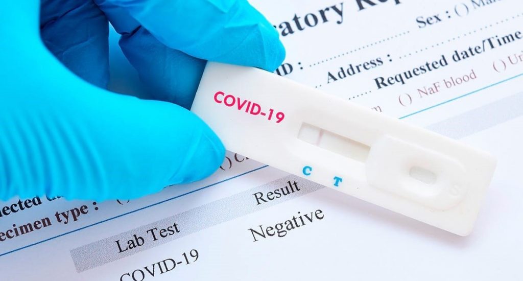 Se elevan a 15,264 contagios y 468 fallecimientos por coronavirus en el país