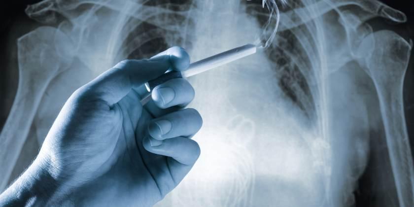 64% de los casos de cáncer de pulmón son causados por el tabaco, según ...