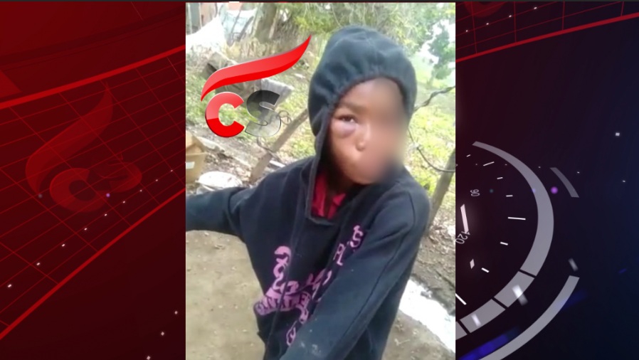 Madre le propina brutal golpiza a hija de 10 años, casi le saca un ojo