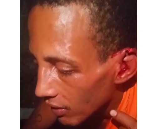 Hombre denuncia agresión con tiros y arma blanca por disputa de drogas en Monte Plata